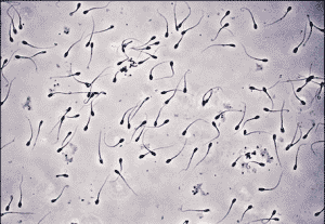 canine semen analysis
