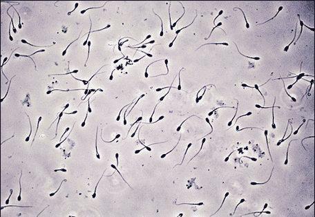 canine semen analysis