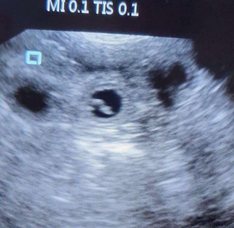 Ultrasound scanning for bulldogs